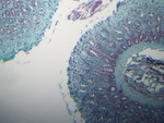 MISSING THUMBNAIL